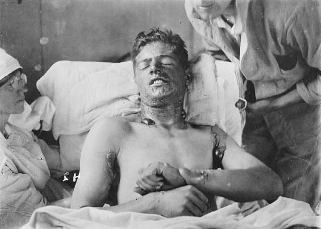 WWI photos show realities of injured soldiers in hospital